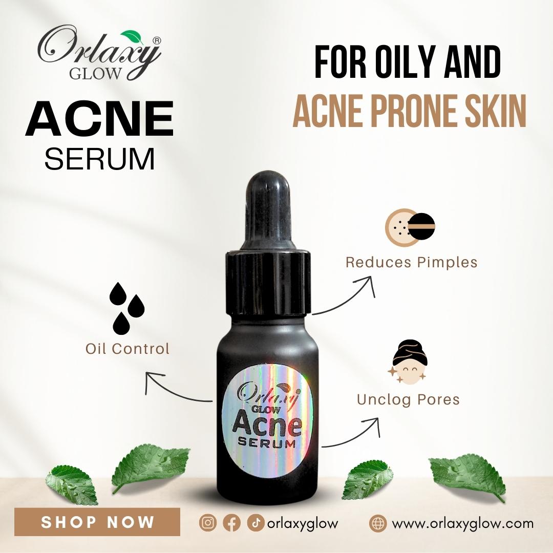 Acne Serum - For Oily & Acne Prone Skin